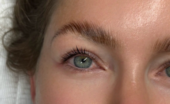 Brow